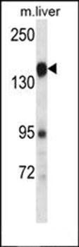PLXNC1 antibody