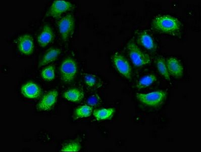 PLXND1 Antibody