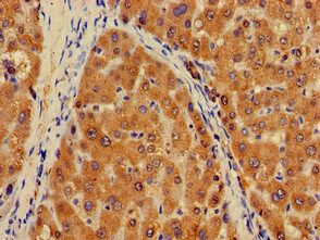 PLXND1 Antibody
