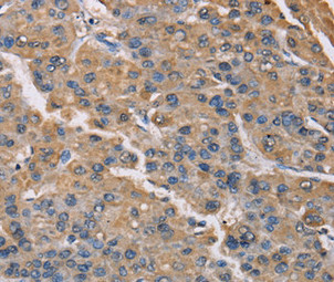 PMAIP1 antibody