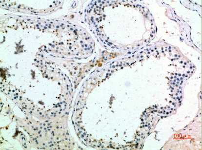 PMCH Antibody