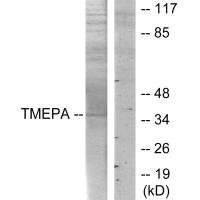 PMEPA1 Antibody