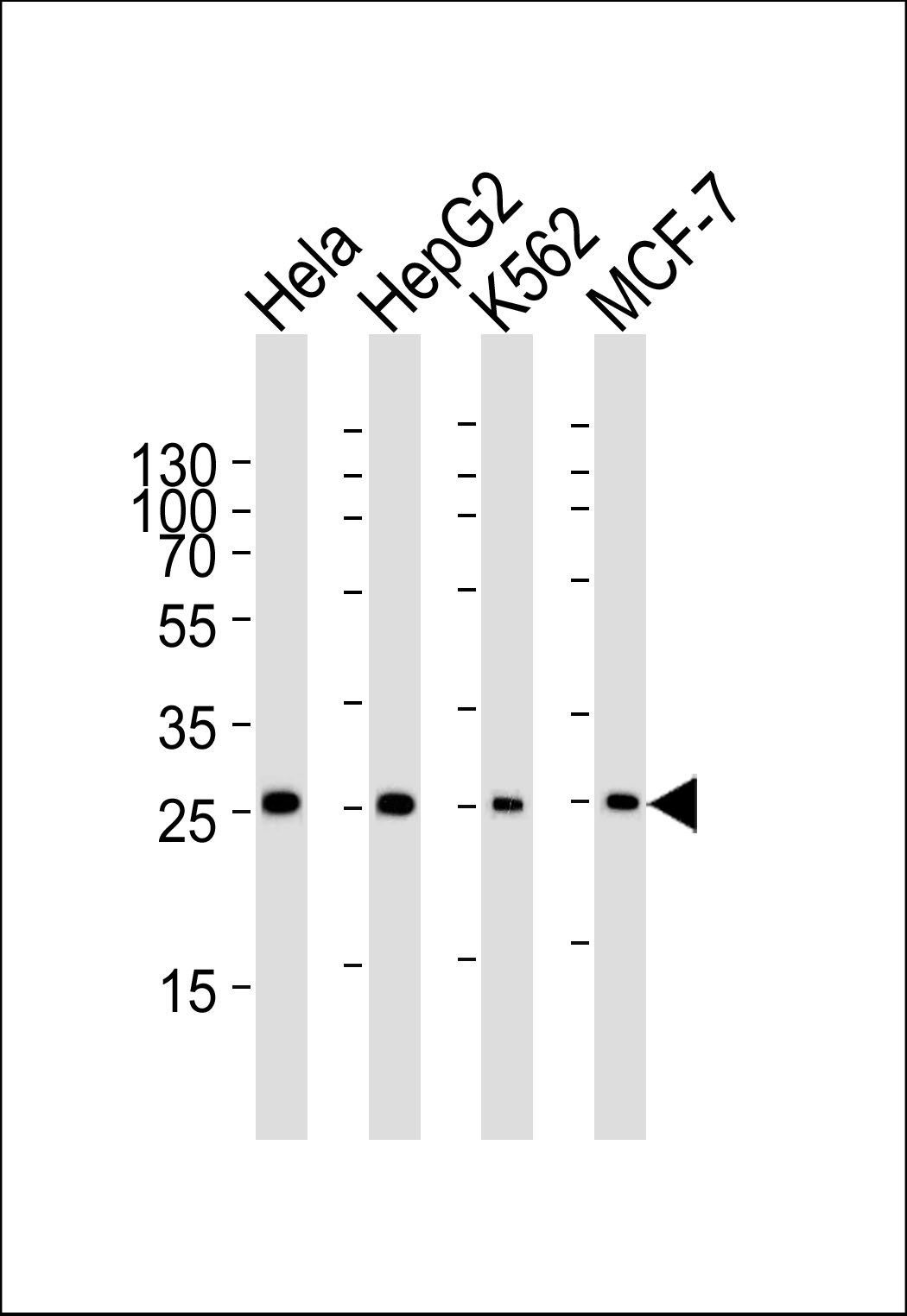 PMM2 antibody
