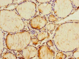 PMM2 Antibody