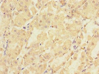 PMM2 Antibody
