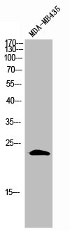 PMP22 Antibody