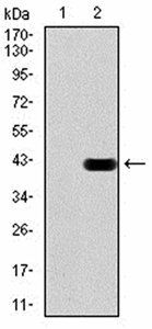 PMS2 Antibody