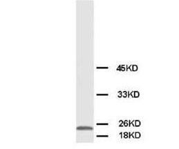 Phosphomevalonate kinase PMVK Antibody