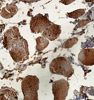PMVK Rabbit Polyclonal Antibody