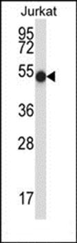 PNKP antibody