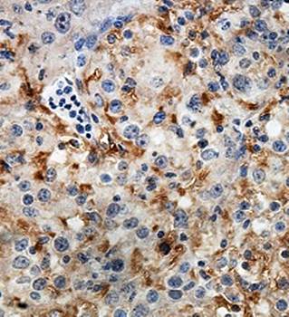 PNLIPRP1 antibody