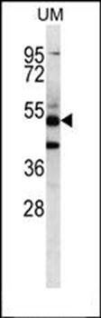 PNLIPRP3 antibody