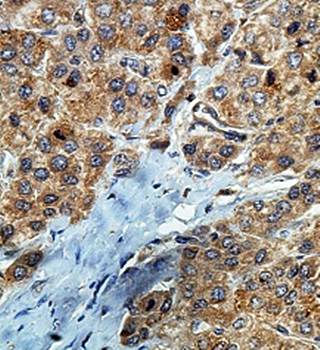 PNLIPRP3 Rabbit Polyclonal Antibody