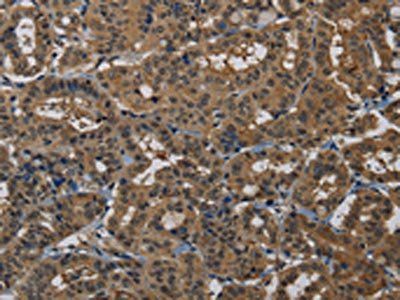PNN Antibody