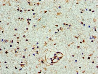 PNP Antibody