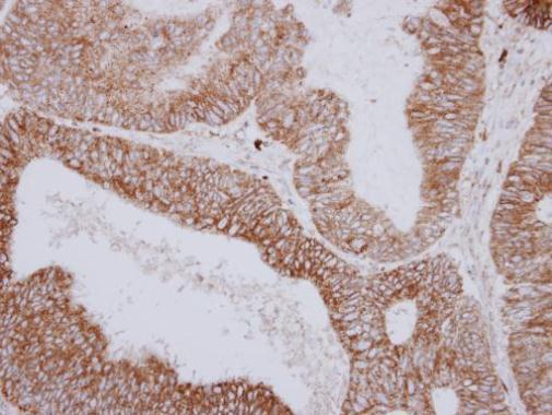 PNPase Rabbit Polyclonal Antibody