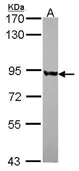 polyribonucleotide nucleotidyltransferase 1 Antibody