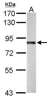 polyribonucleotide nucleotidyltransferase 1 Antibody