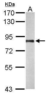 PNPase antibody