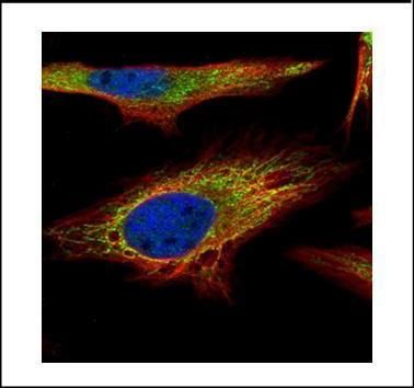 PNPase Rabbit Polyclonal Antibody