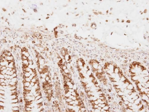 PNPase antibody