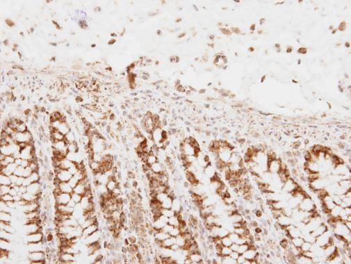 polyribonucleotide nucleotidyltransferase 1 Antibody