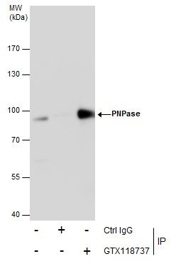 polyribonucleotide nucleotidyltransferase 1 Antibody