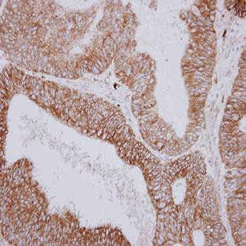 PNPase antibody