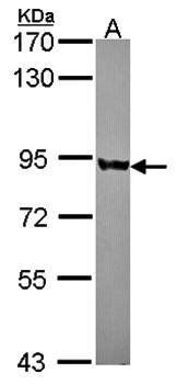 PNPase antibody
