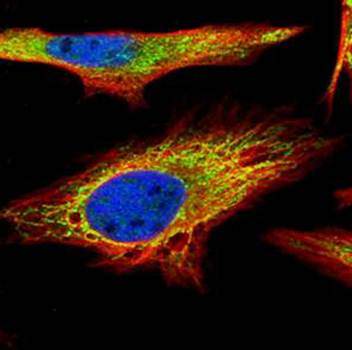 PNPase antibody