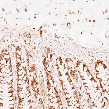 PNPase antibody