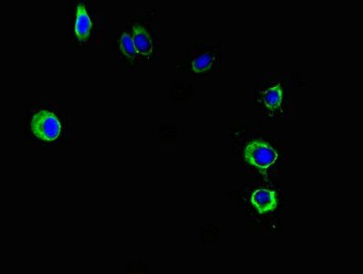 PNPLA2 Antibody