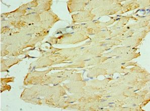 PNPLA2 Antibody