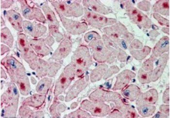 Goat anti-ATGL / Desnutrin Antibody