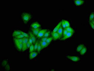 PNPLA5 Antibody