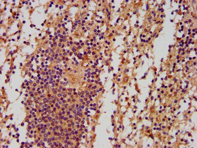 PNPLA5 Antibody
