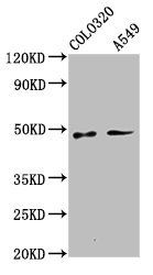 PNPLA5 Antibody