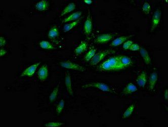 PNPLA6 Antibody