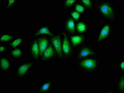PNPLA8 Antibody