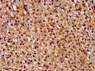 PNPLA8 Antibody