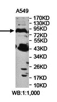 PNPLA8 antibody