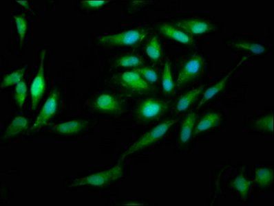 PNPO antibody