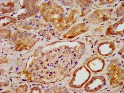 PNPO Antibody
