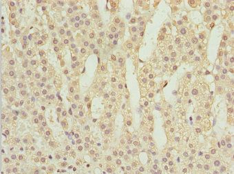 POC1A Antibody