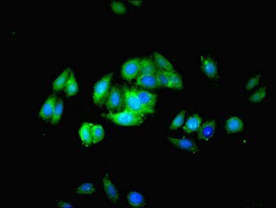 Podocalyxin antibody