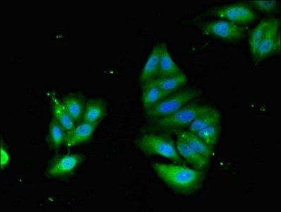 Podocalyxin antibody