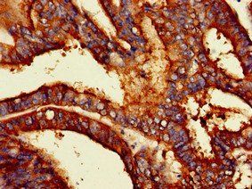 PODXL Antibody
