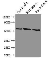 Podocalyxin antibody