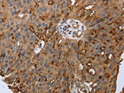 PODXL Antibody