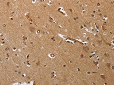PODXL Antibody